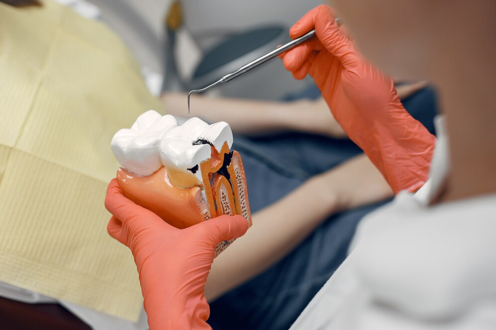 Root Canal Treatment in banjara hills