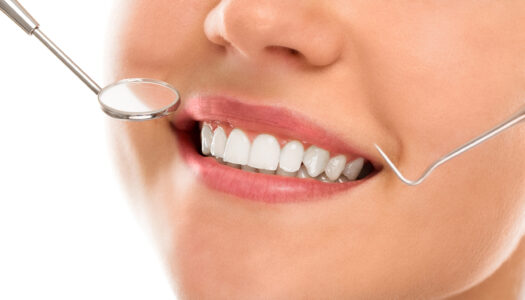 smile designing cost in hyderabad