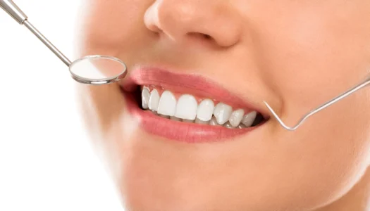 smile designing cost in hyderabad