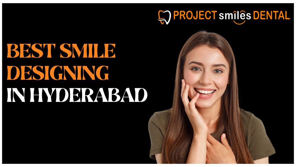 Best Smile Designing in Hyderabad
