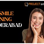 Best Smile Designing in Hyderabad