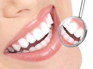 How to Choose the Right Dental Crown