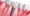 root canal treatment cost