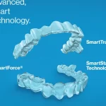 invisalign treatment in banjara hills