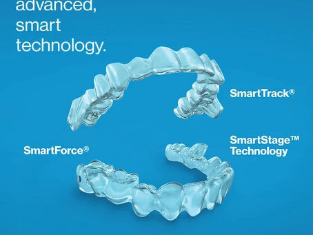 invisalign treatment in banjara hills