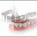 Transform Your Confidence with Clear Aligners