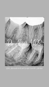 root canal 3
