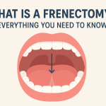 frenectomy treatment in hyderabad