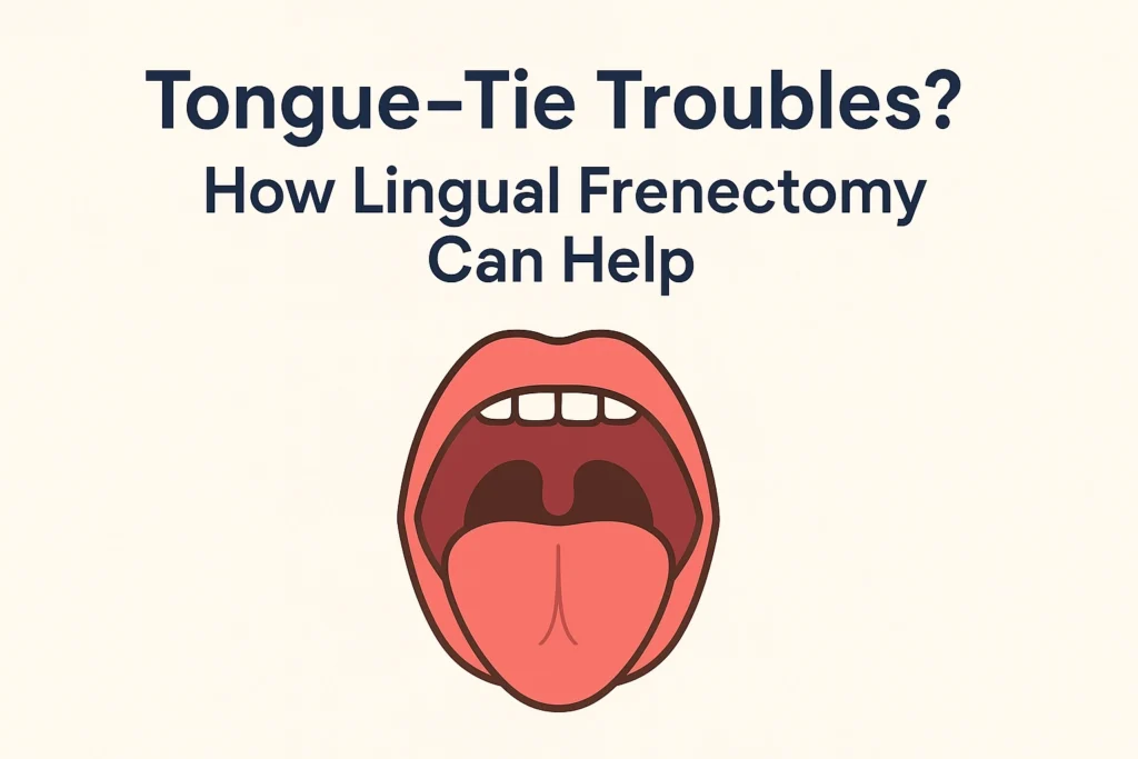 Lingual Frenectomy Treatment in banjara hills