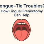 Lingual Frenectomy Treatment in banjara hills