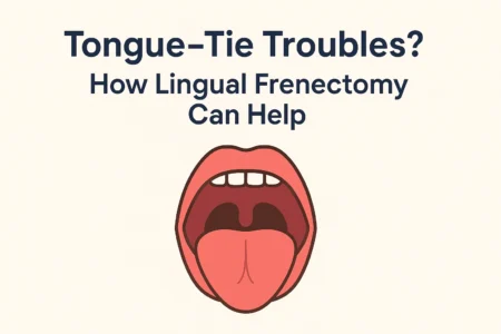 Lingual Frenectomy Treatment in banjara hills