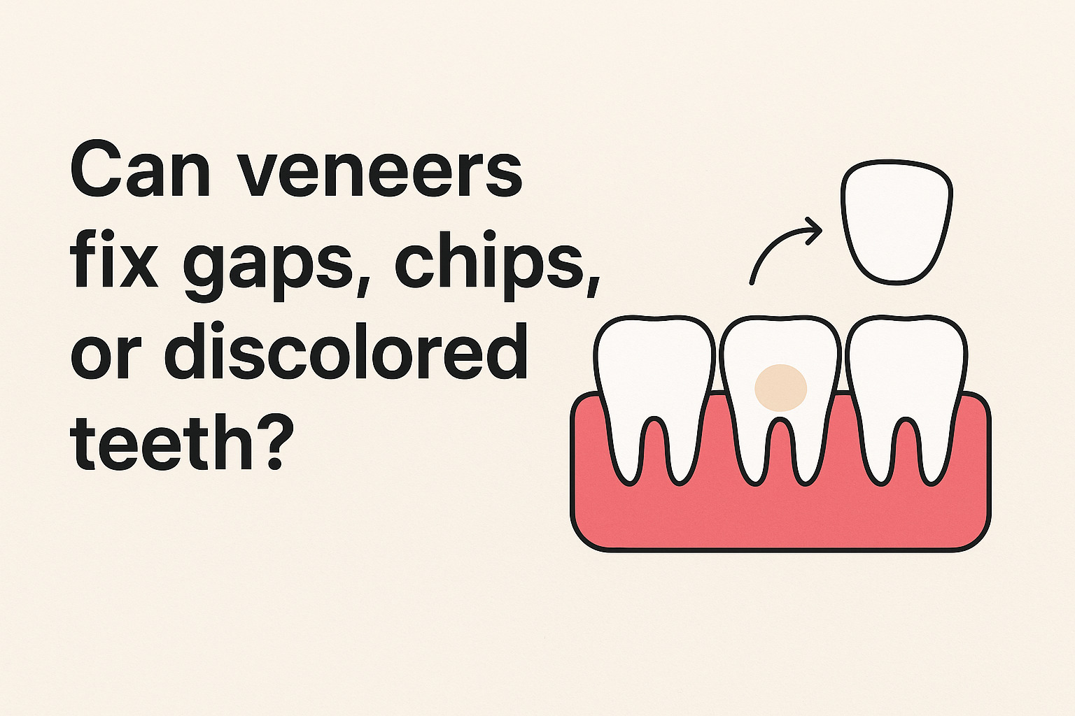 veneers treatment in banjara hills
