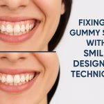 smile designing in banjara hills